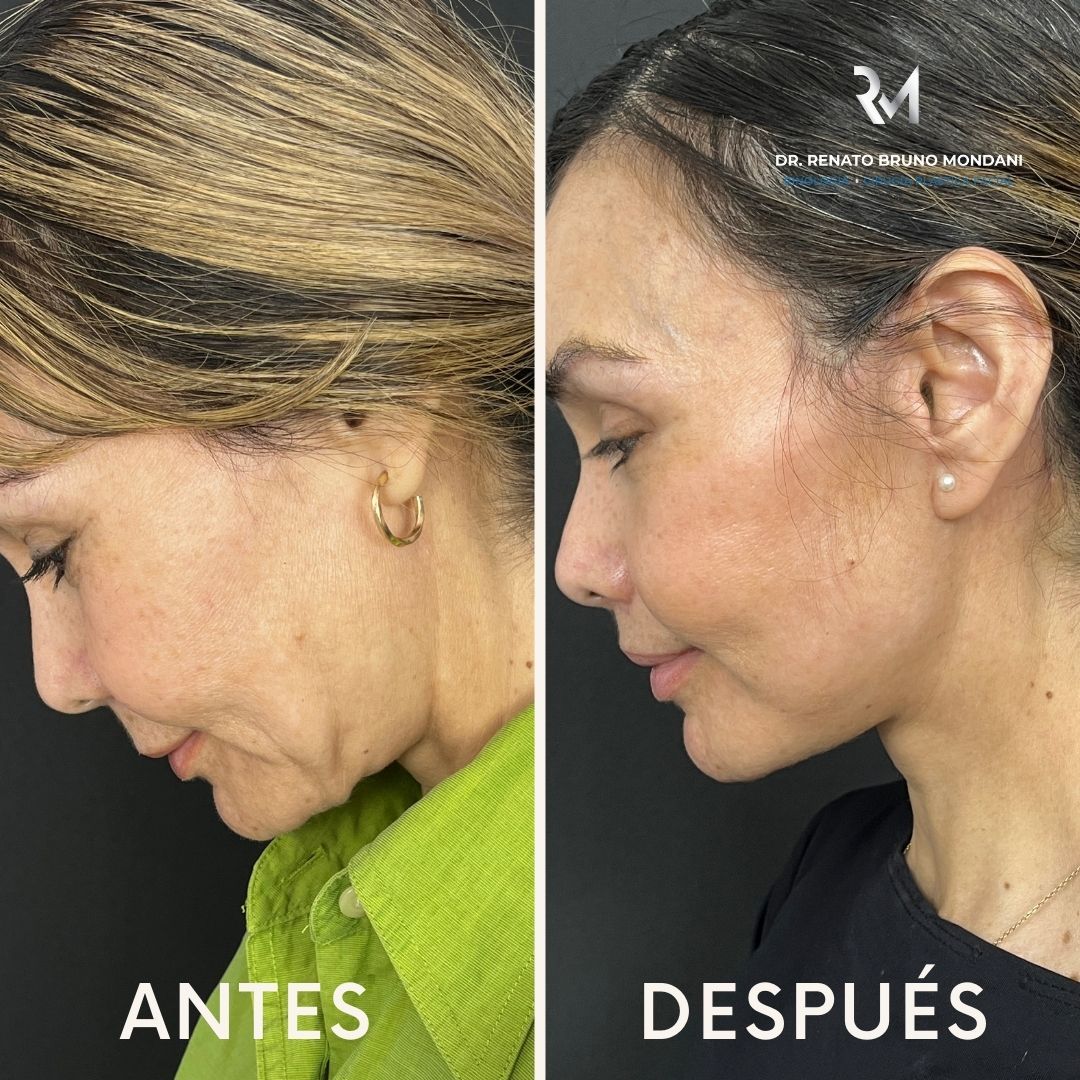 Renato Bruno Mondani-10