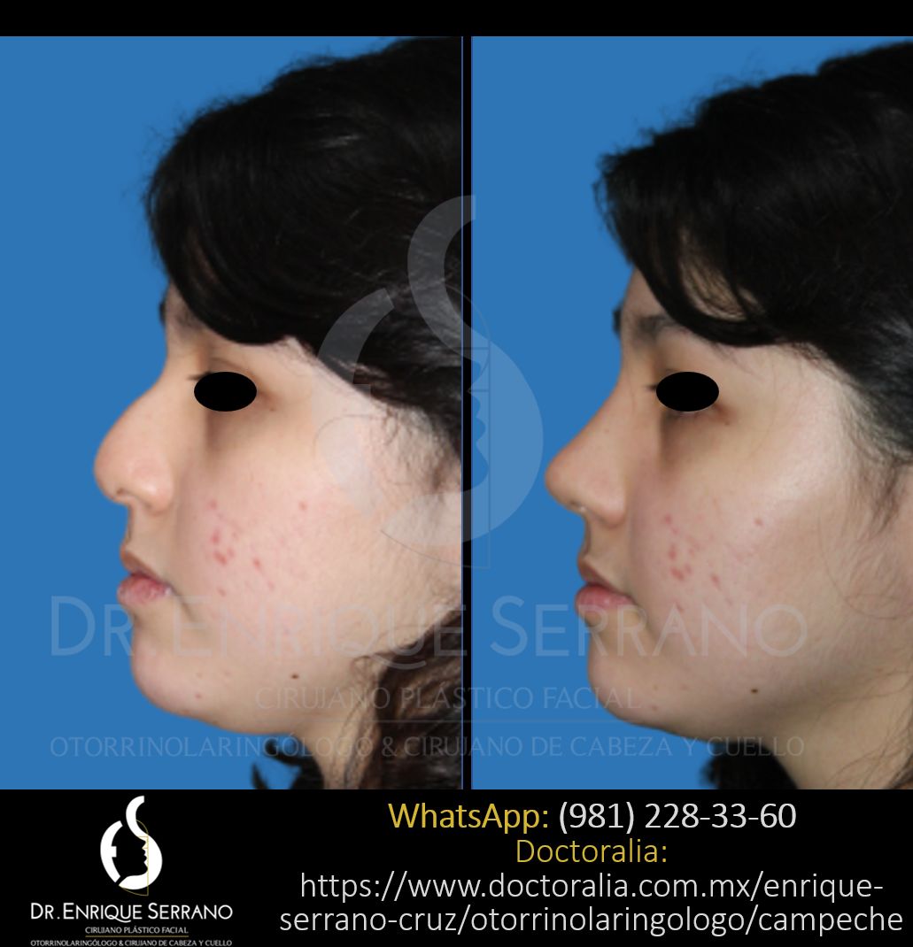 Enrique Serrano Cruz-46