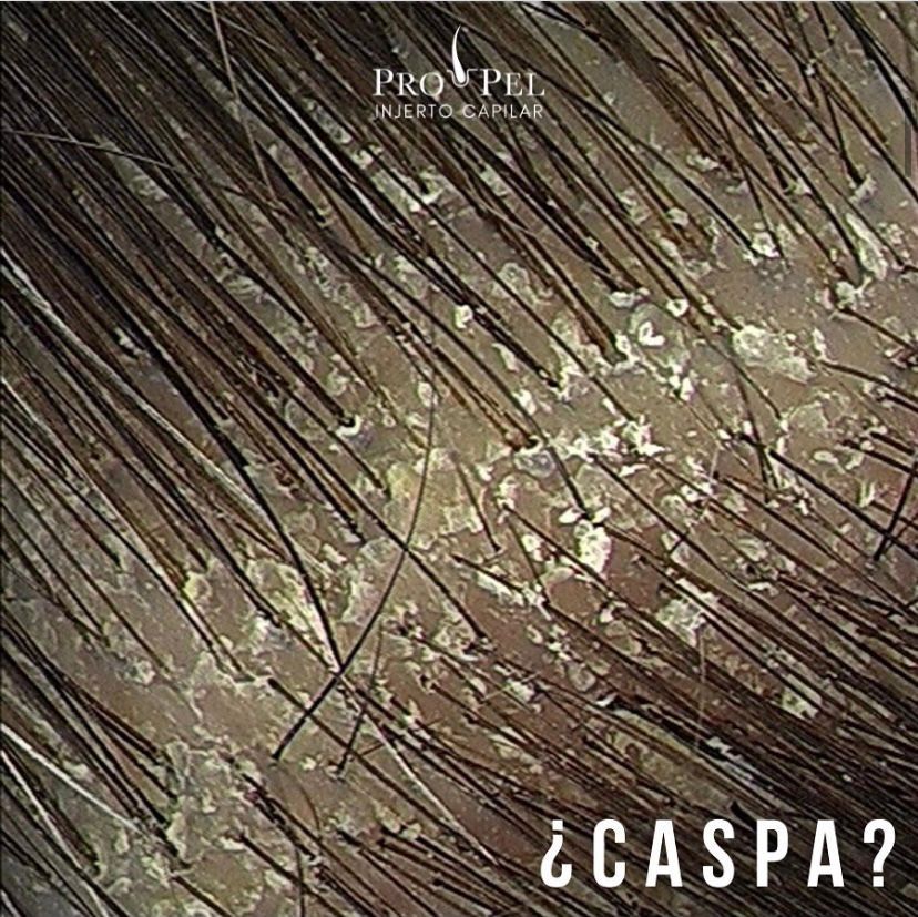 Karla Vanessa Becerra-23