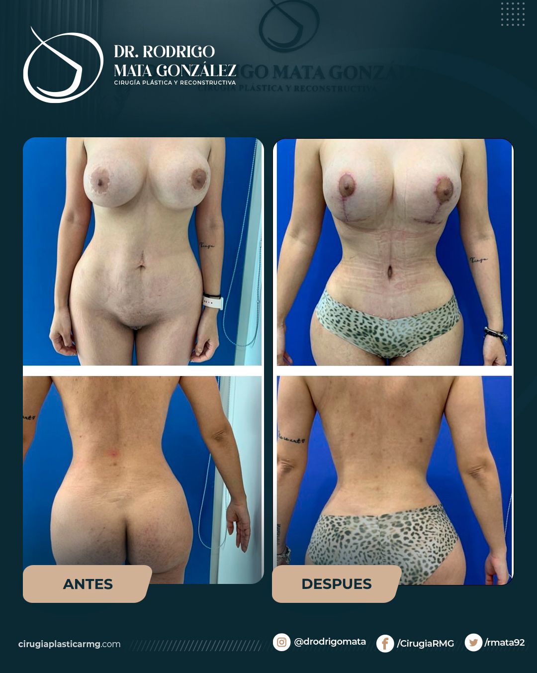 Rodrigo Mata Gonzalez-20