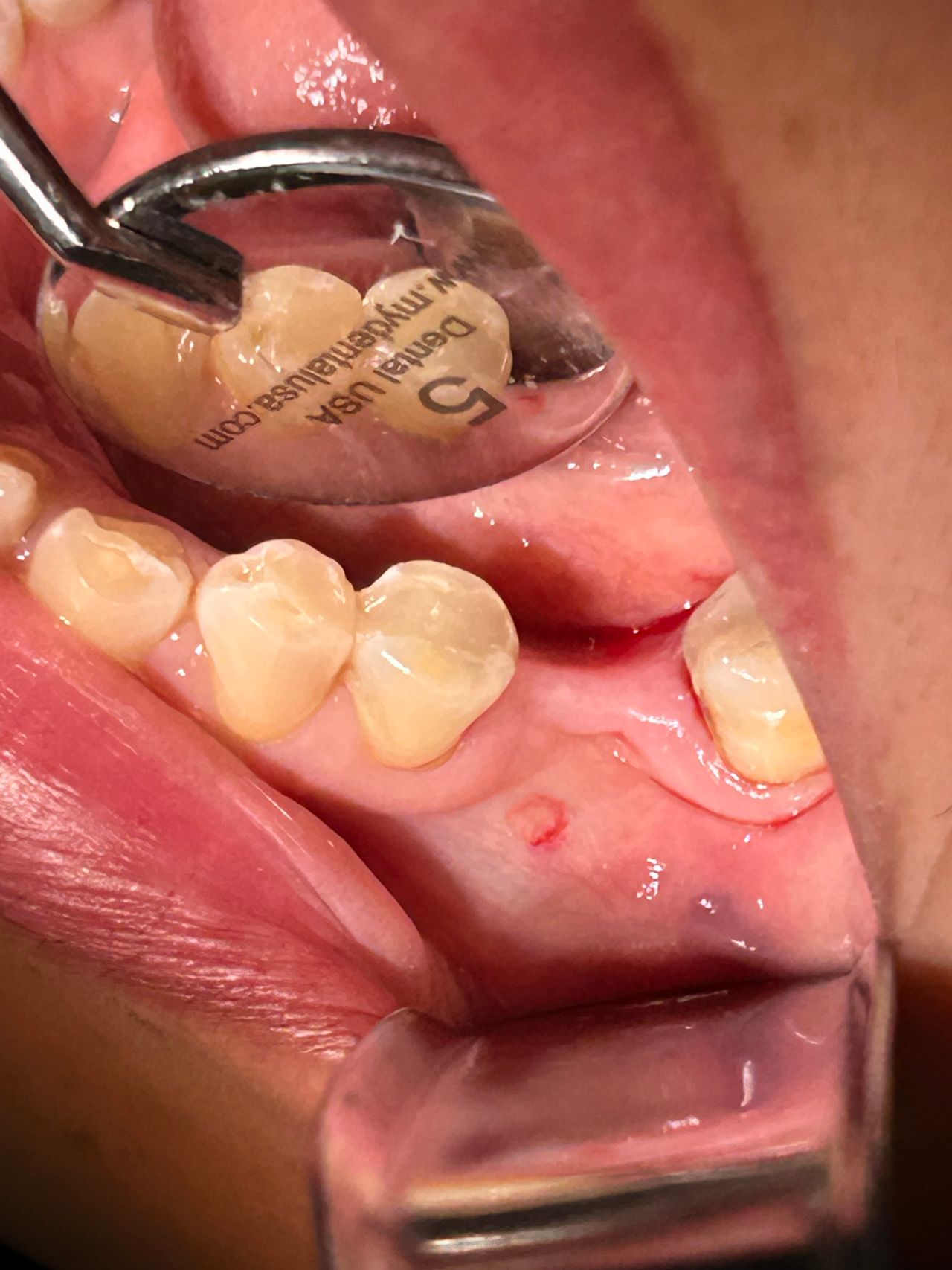 Mauricio Burgos Sánchez-15