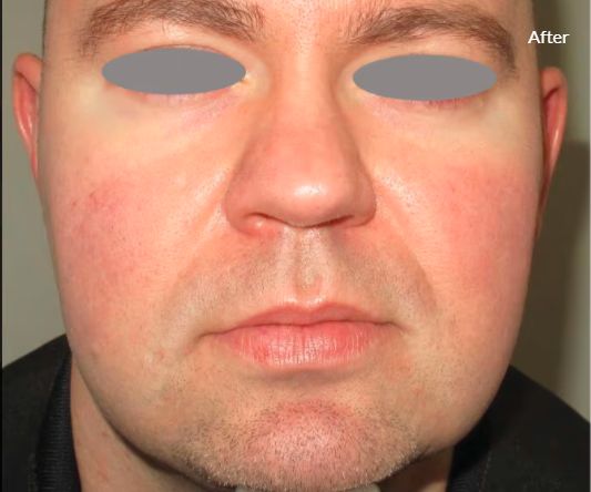 Jorge Luis Villalobos Ibarra-7