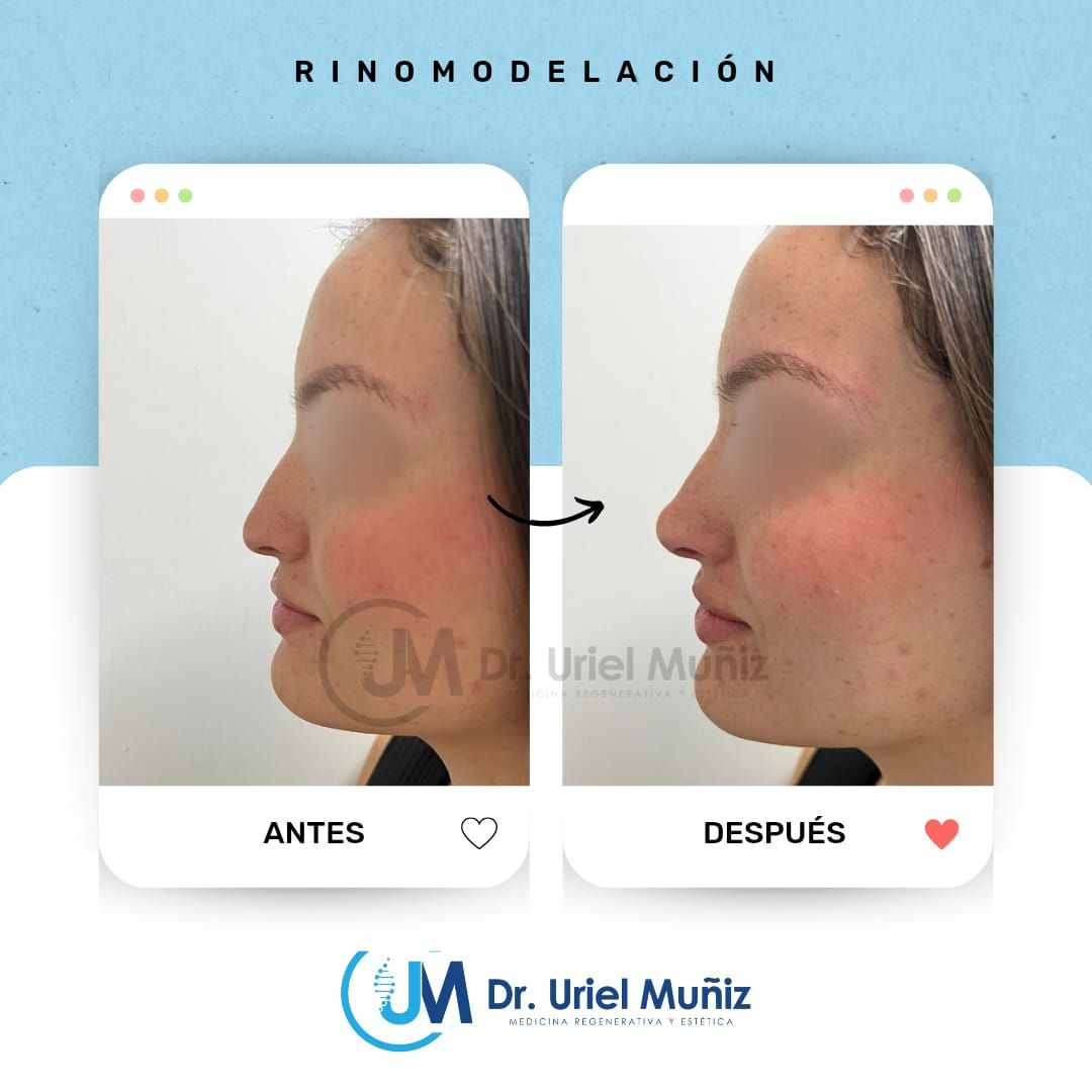 Teófilo Uriel Muñiz Chávez-30