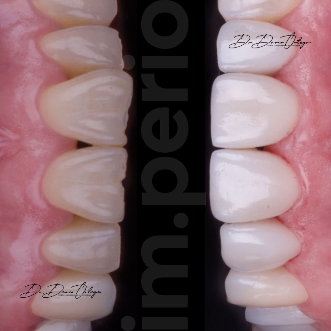 Dario Ortega Aceves-21