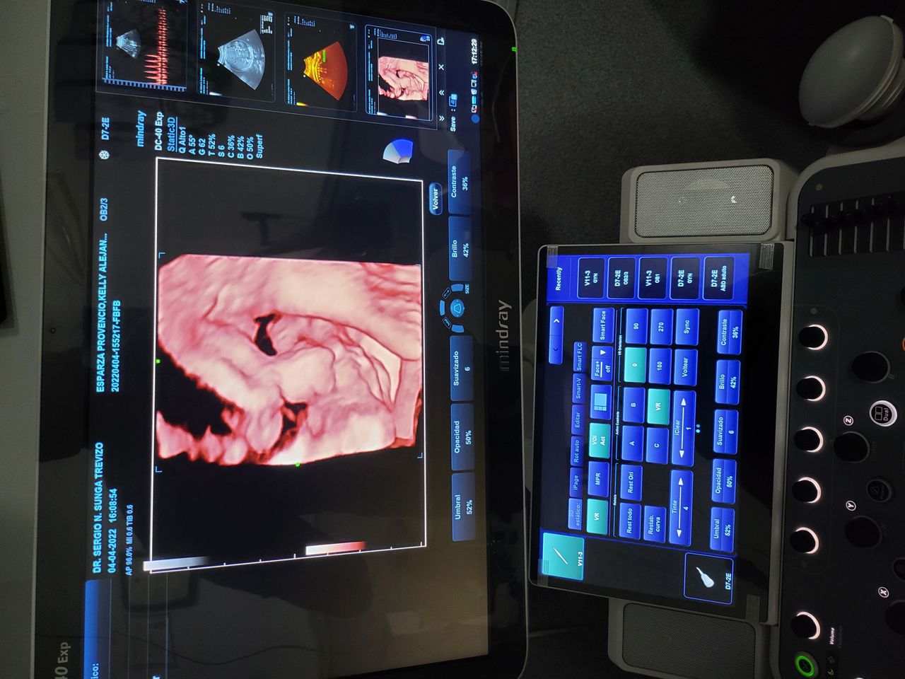 Sergio Nicolas Sunga Trevizo-4