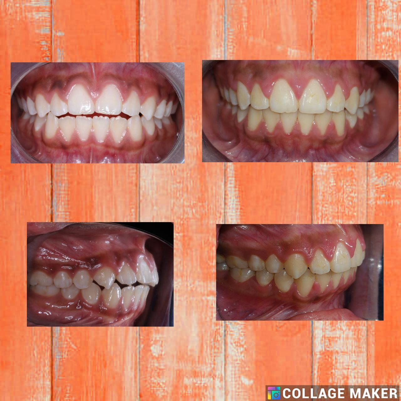 Ryan Michael Brenes Pacheco-16