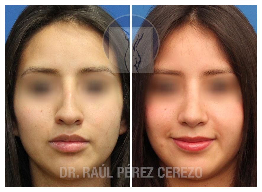 Raúl Pérez Cerezo-15