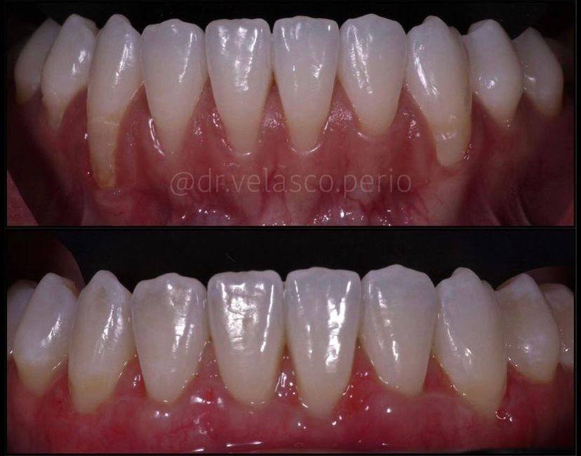 Ricardo Velasco Avelar-8