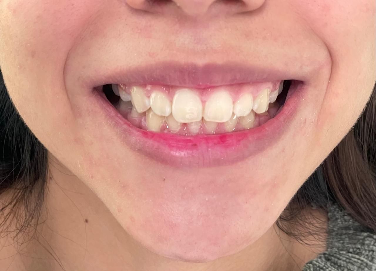 Anuar Becerril Castro-9