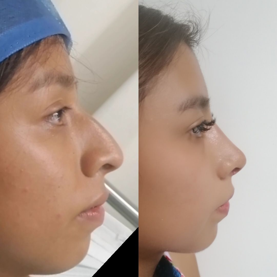 Erendira Santiago Santiesteban-13