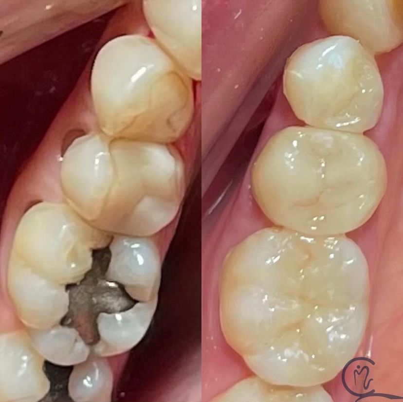 Mari Carmen Platas Canales-0