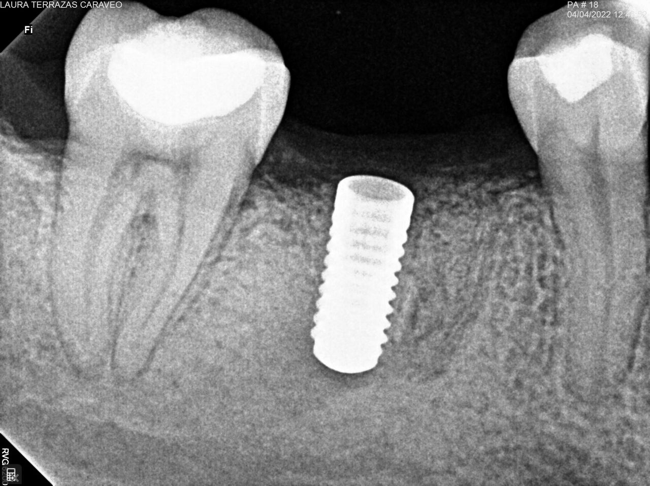 Tatiana Ortega Arrieta-0