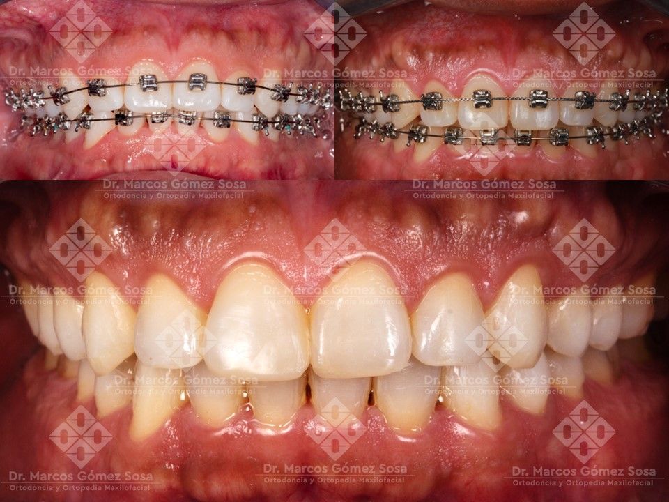 Marcos Gómez Sosa-3