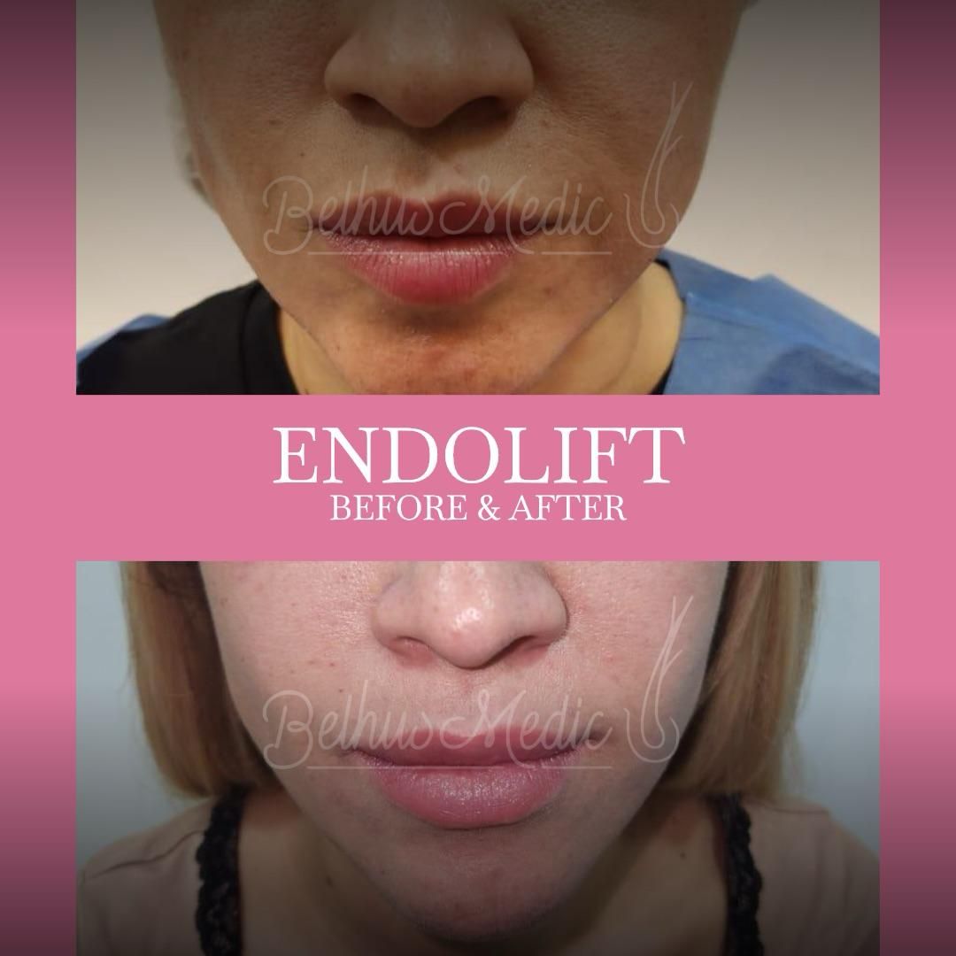 Alejandra Soriano Elorza-83