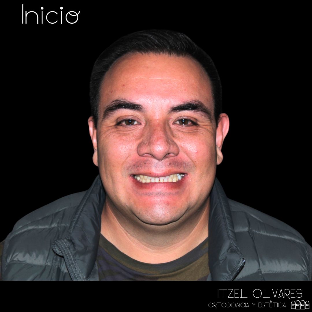 Itzel Olivares Lara-6