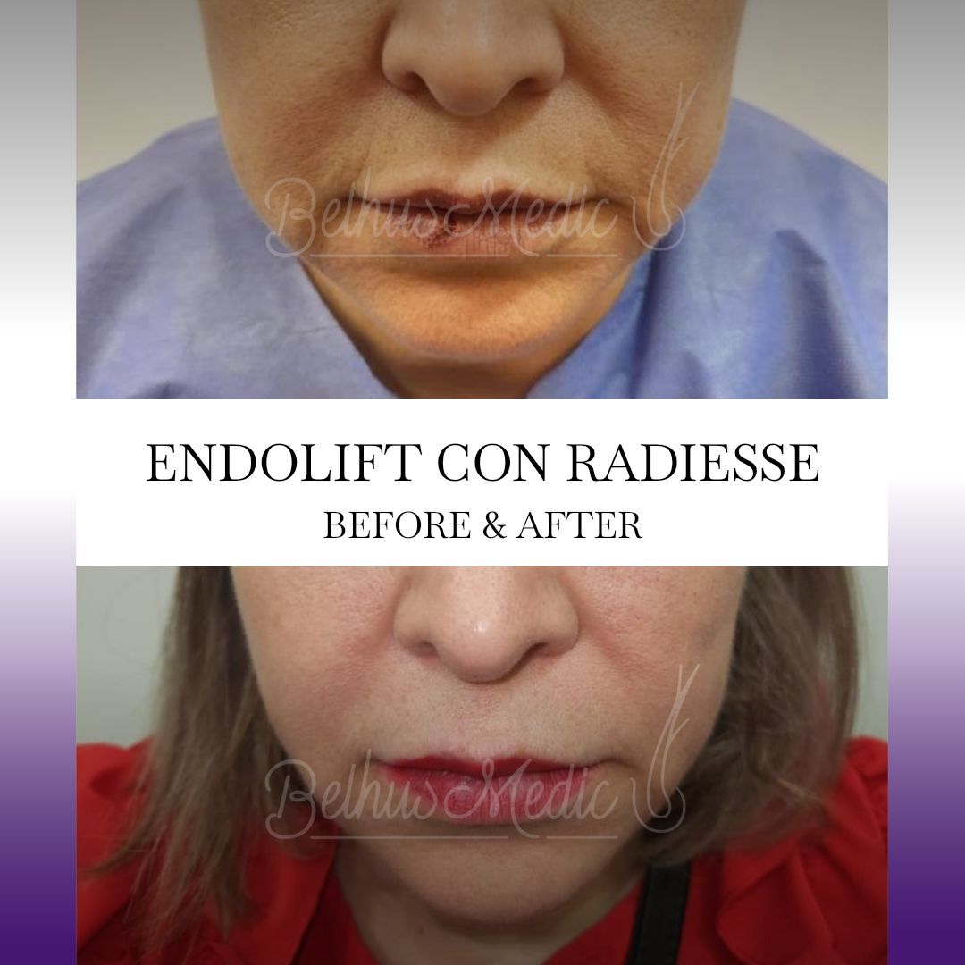 Alejandra Soriano Elorza-103