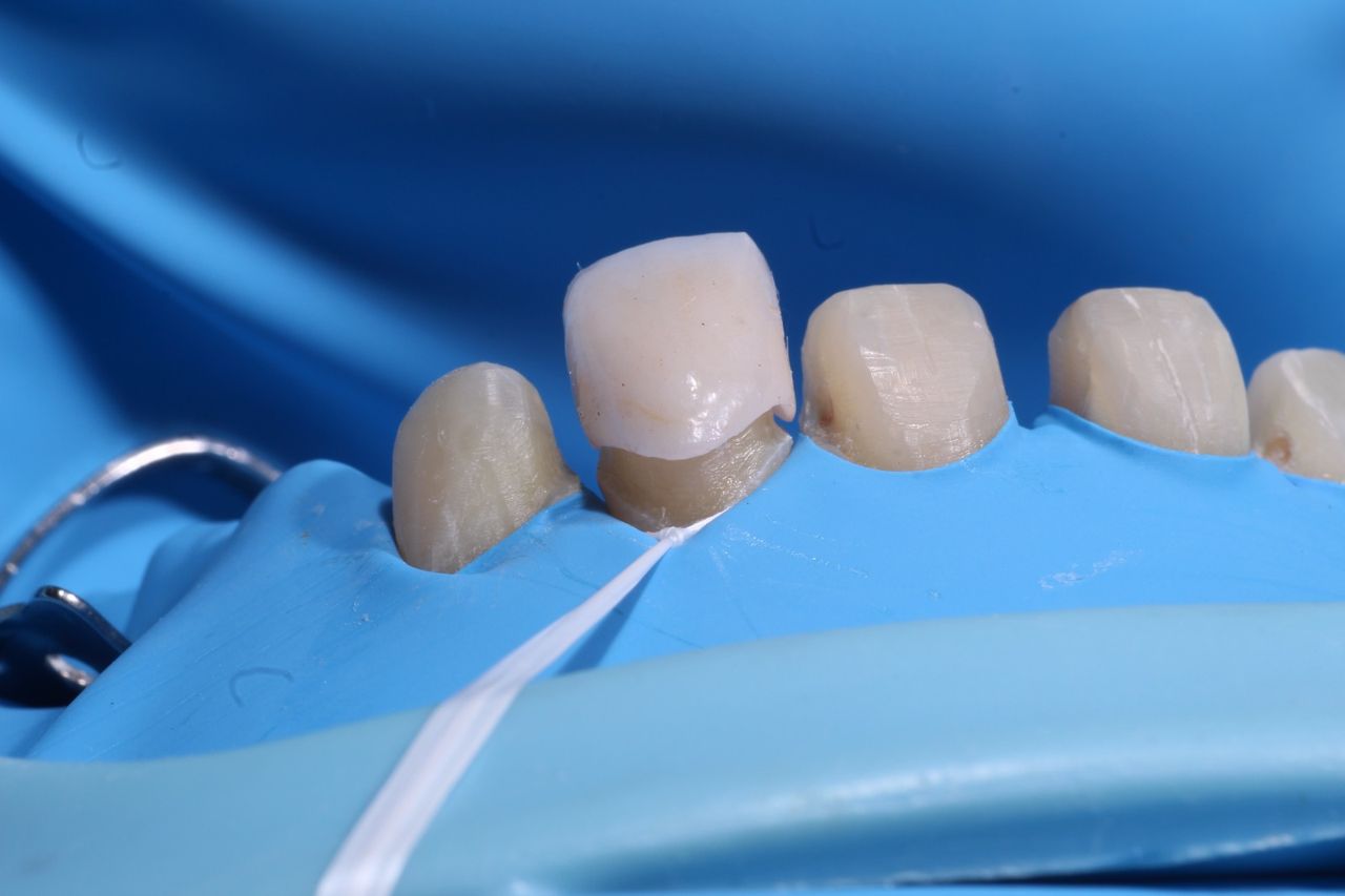 Fredy Alejandro Roblero Gónzalez-70