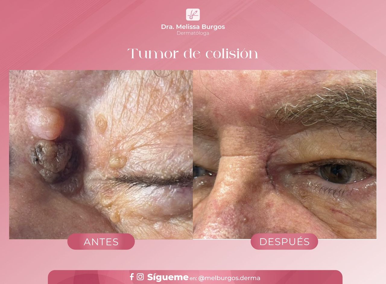 Melissa Burgos Romero-9