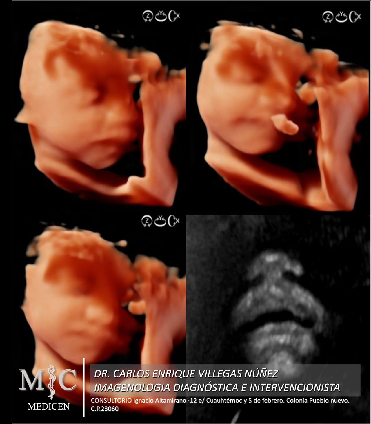 Carlos Enrique Villegas Nuñez-8