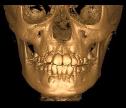 Luis Enrique Cruz Hernández-37