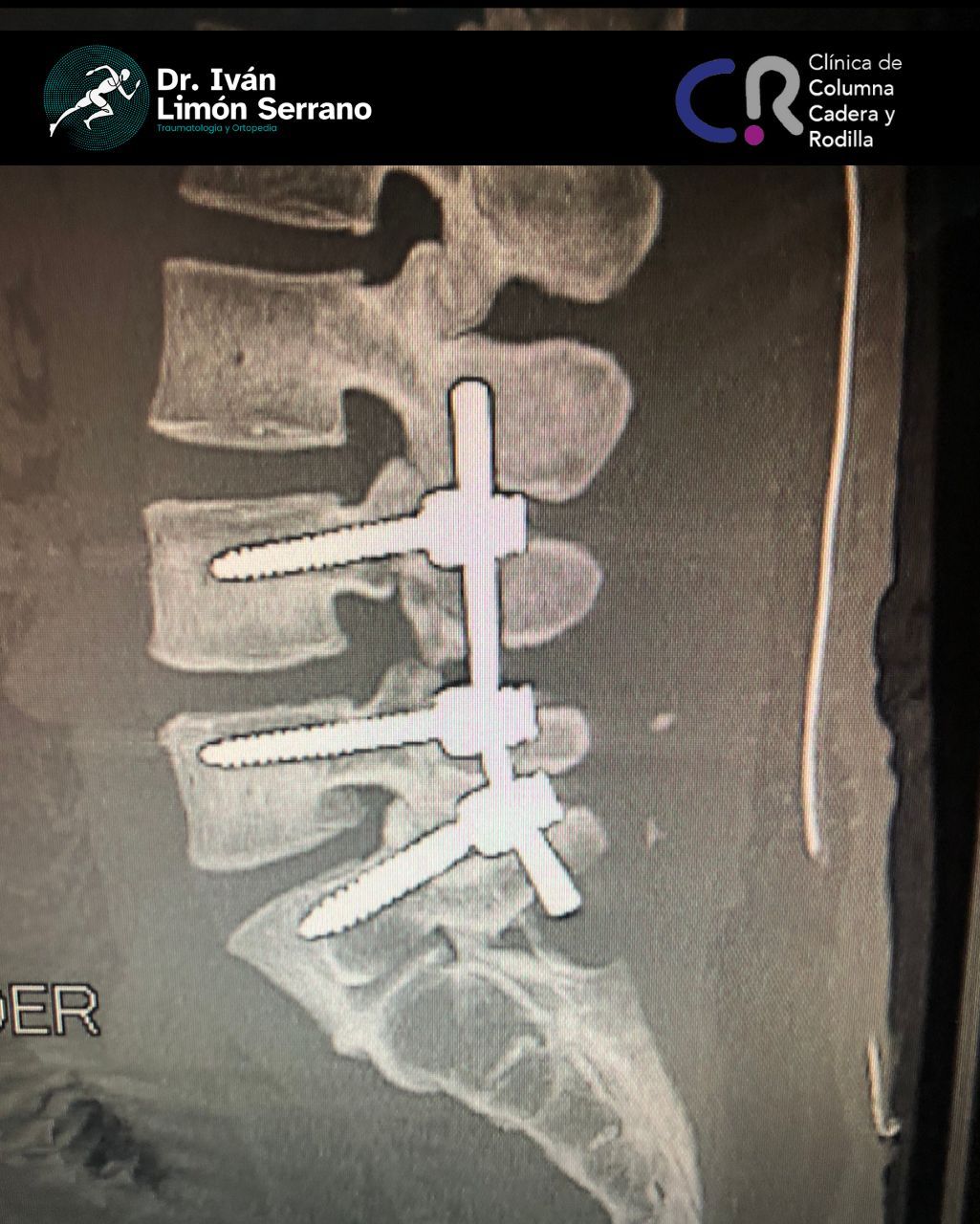 Iván Limón Serrano-28