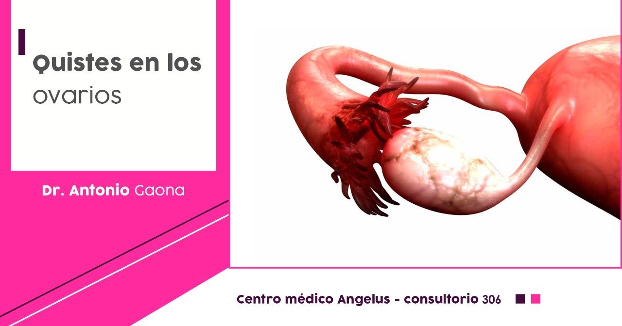 José Antonio Gaona Rodriguez-21