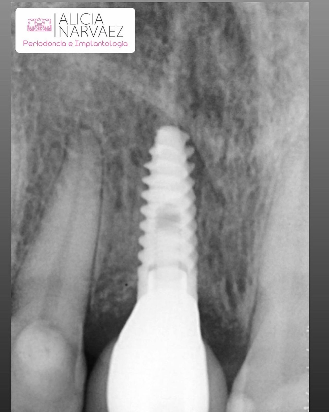 Alicia Narváez Chávez-1