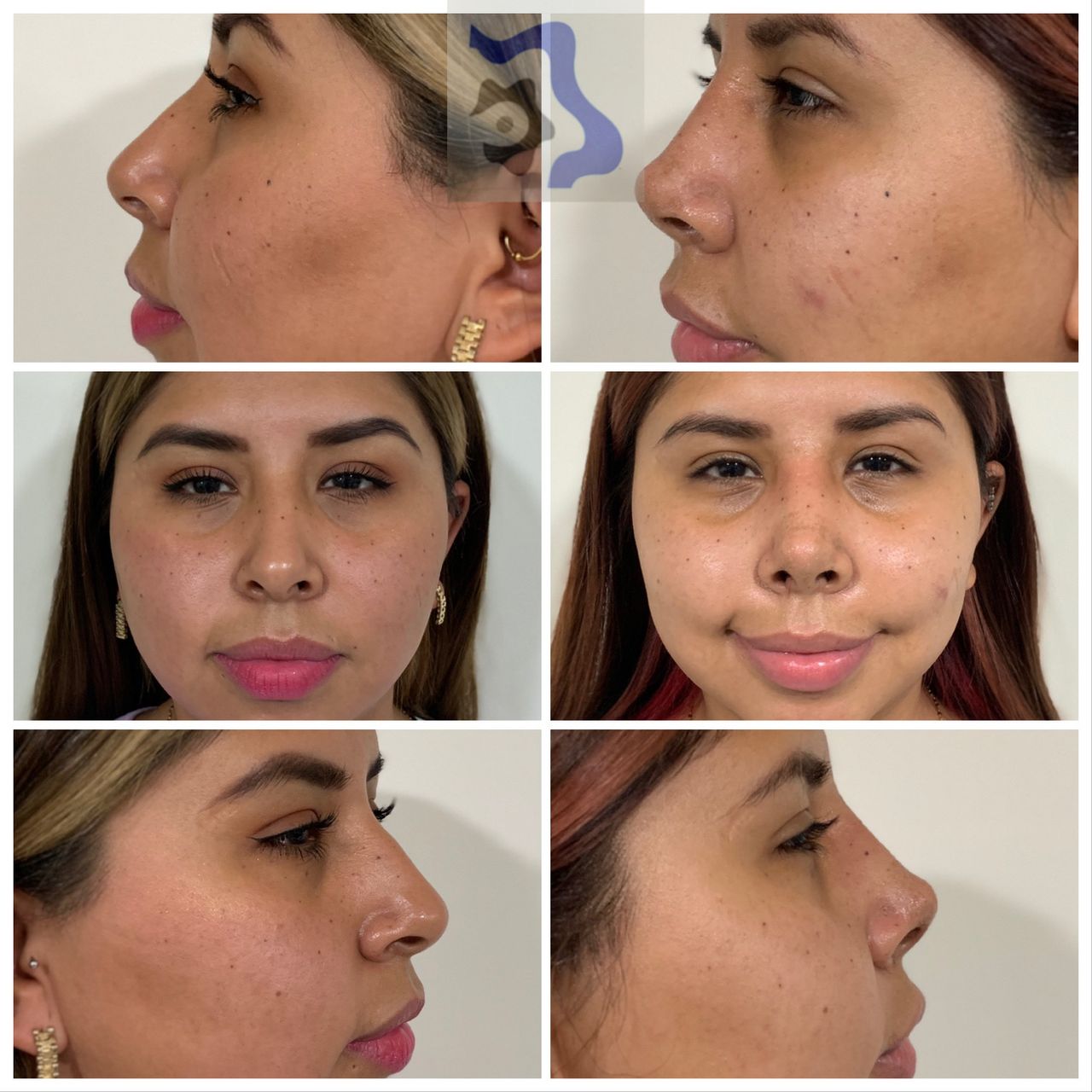 Cesar Alfonso Gutierrez Espinosa-3