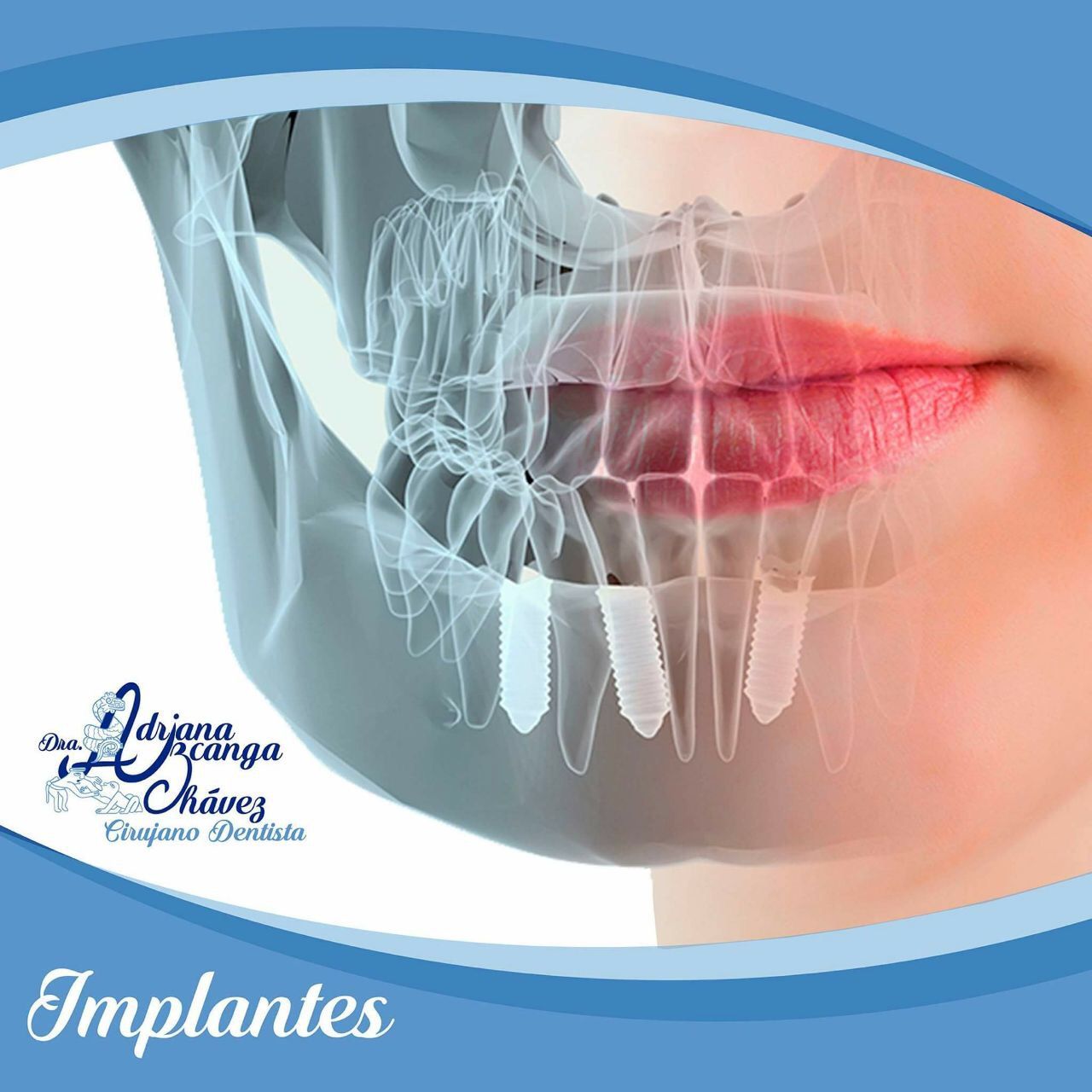 Adriana Uzcanga Chávez-0