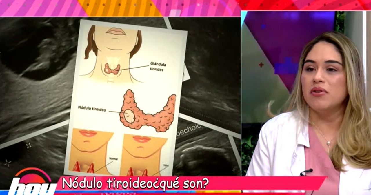 Mary Yeyzel Ortega Aranda-22