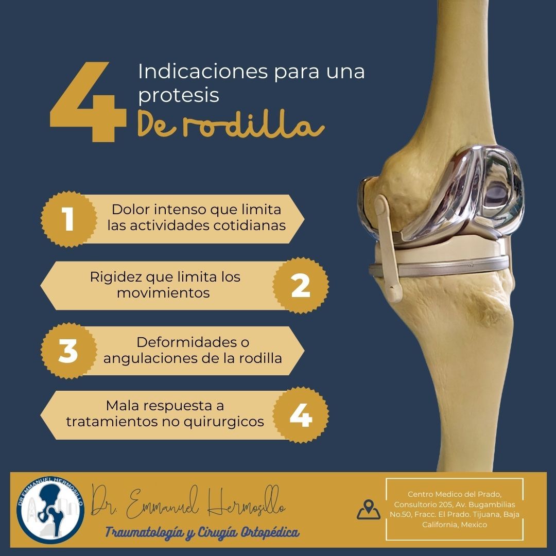 F. Emmanuel Hermosillo Salazar-0