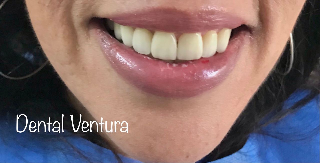 Antonio Cerda Ventura-7