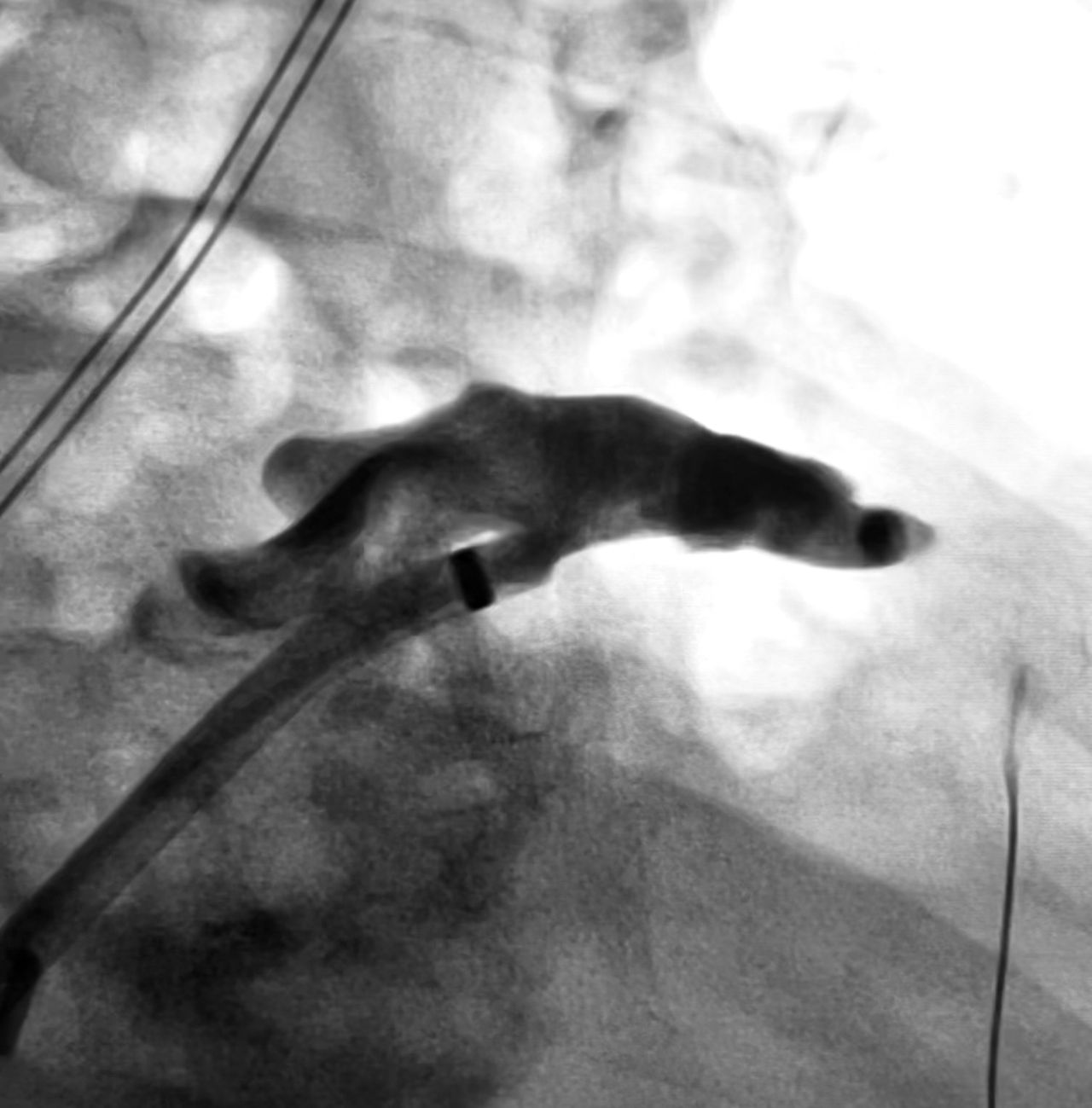 Abdón Ávila Chávez-0