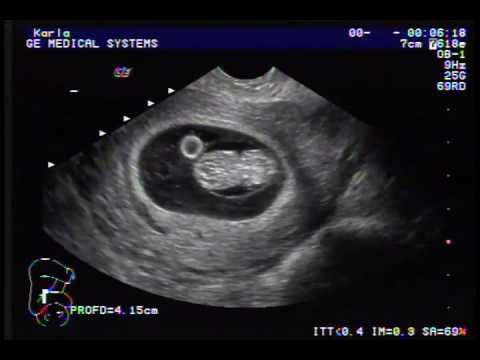 Guadalupe Muñoz Castro-74