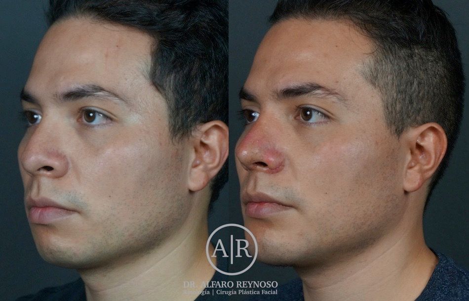 Jose Alberto Alfaro Reynoso-6