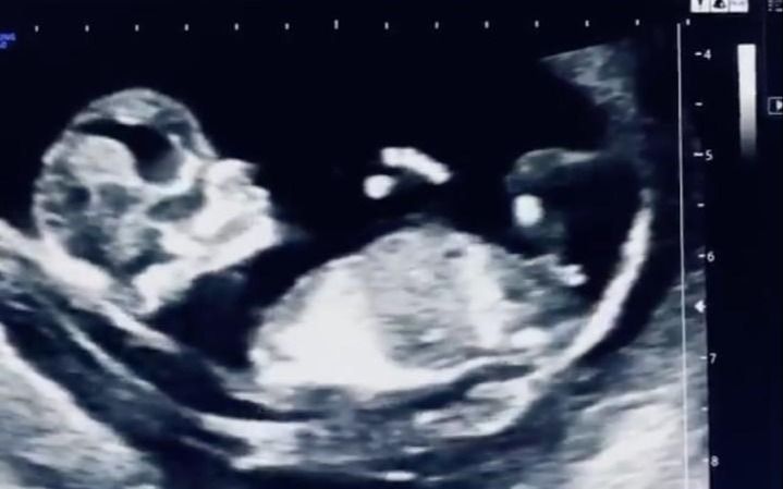 Delia Duran Martinez-0