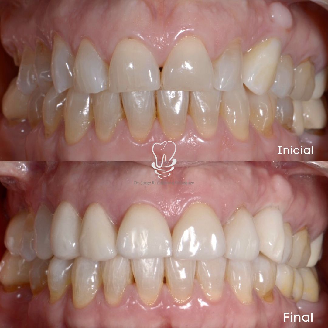 Jorge Rafael Calderón Velázquez-15