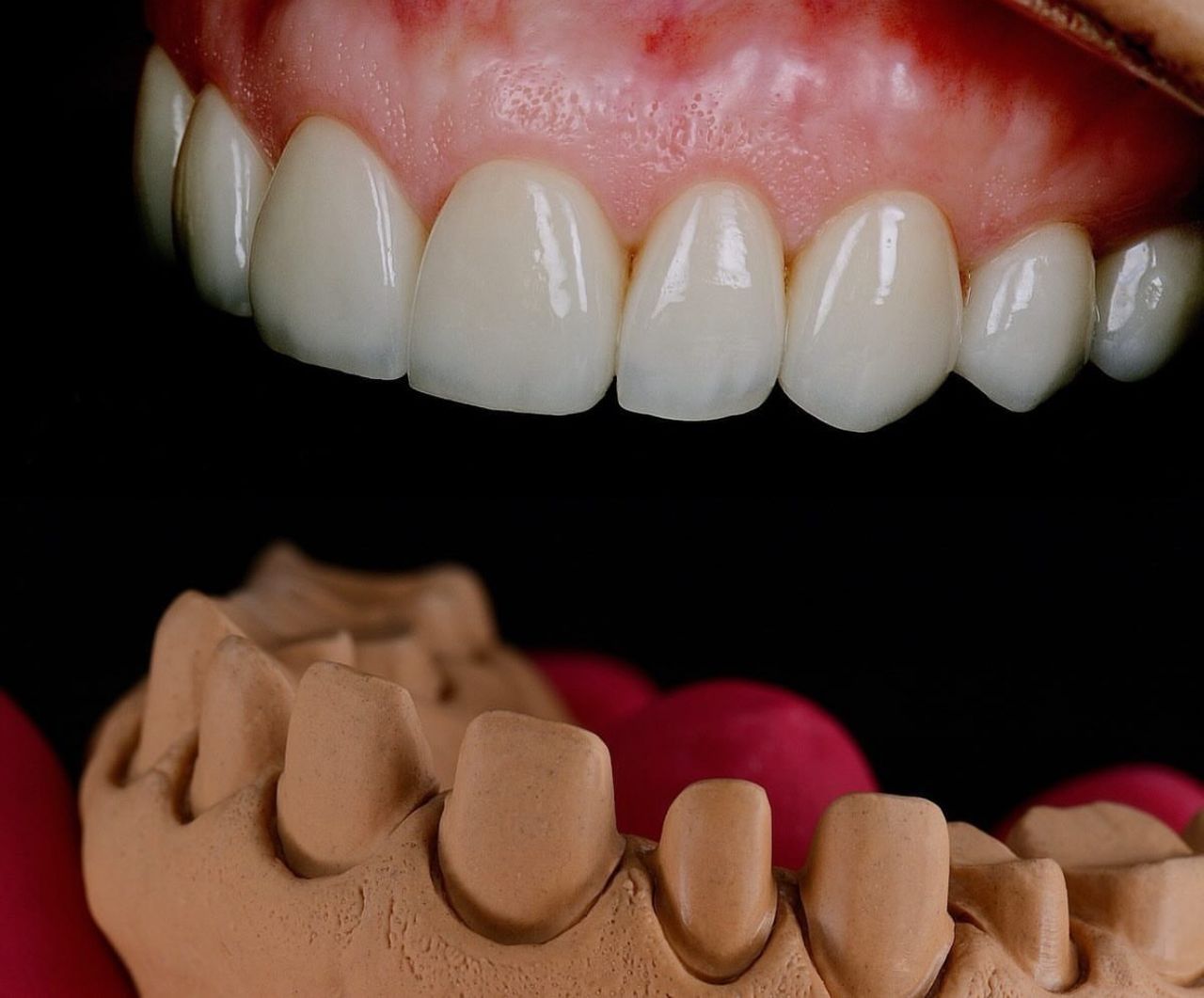 Angel Gabriel Hernández Sánchez-4