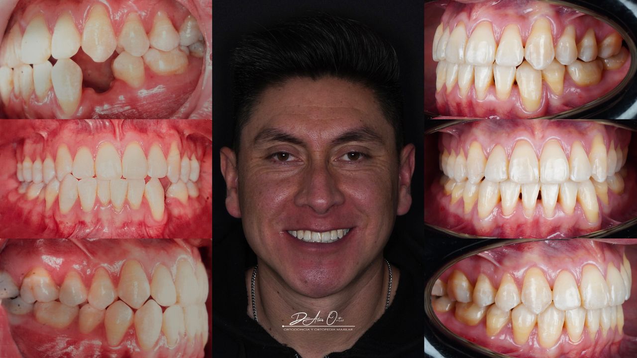 Alan Ortiz-10