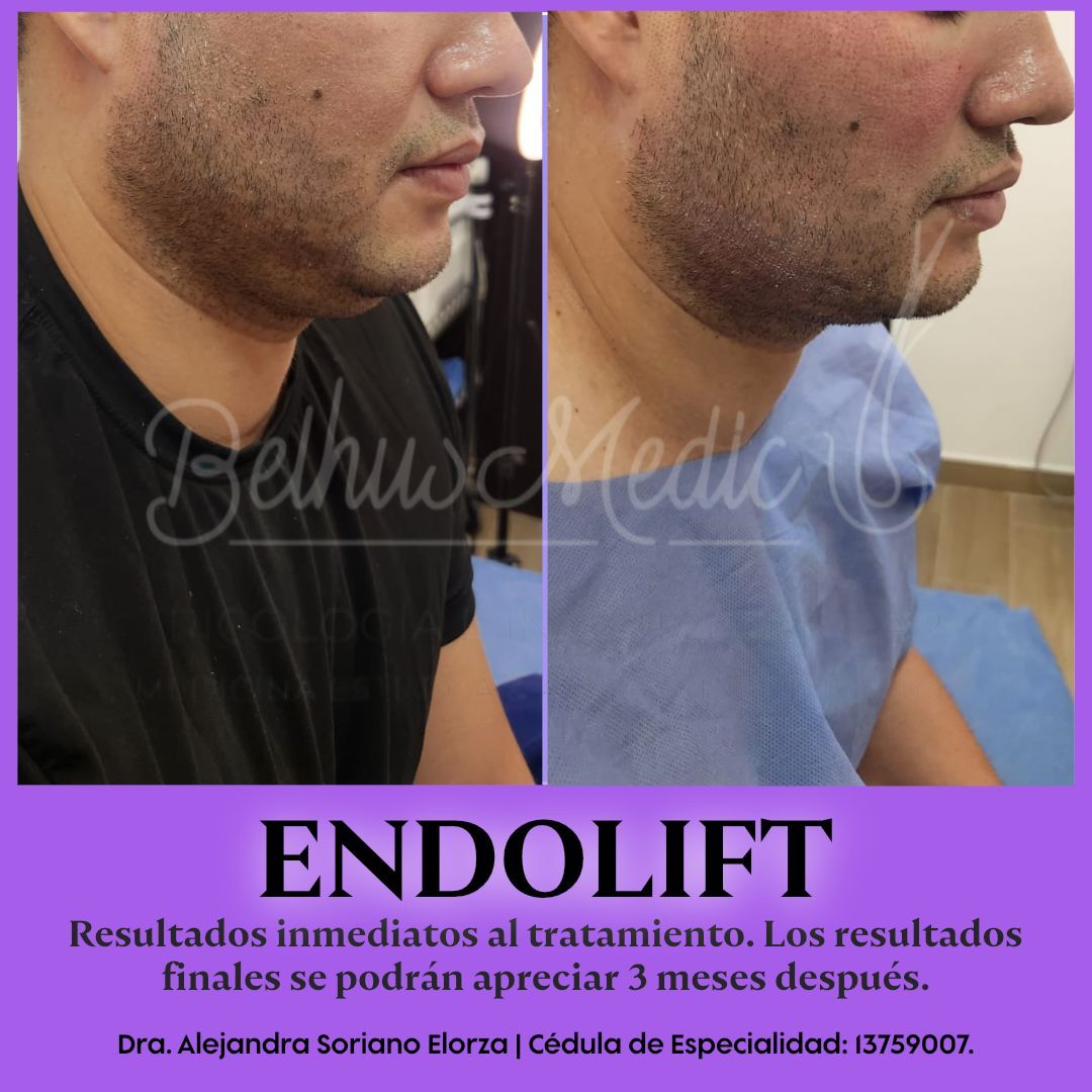 Alejandra Soriano Elorza-15