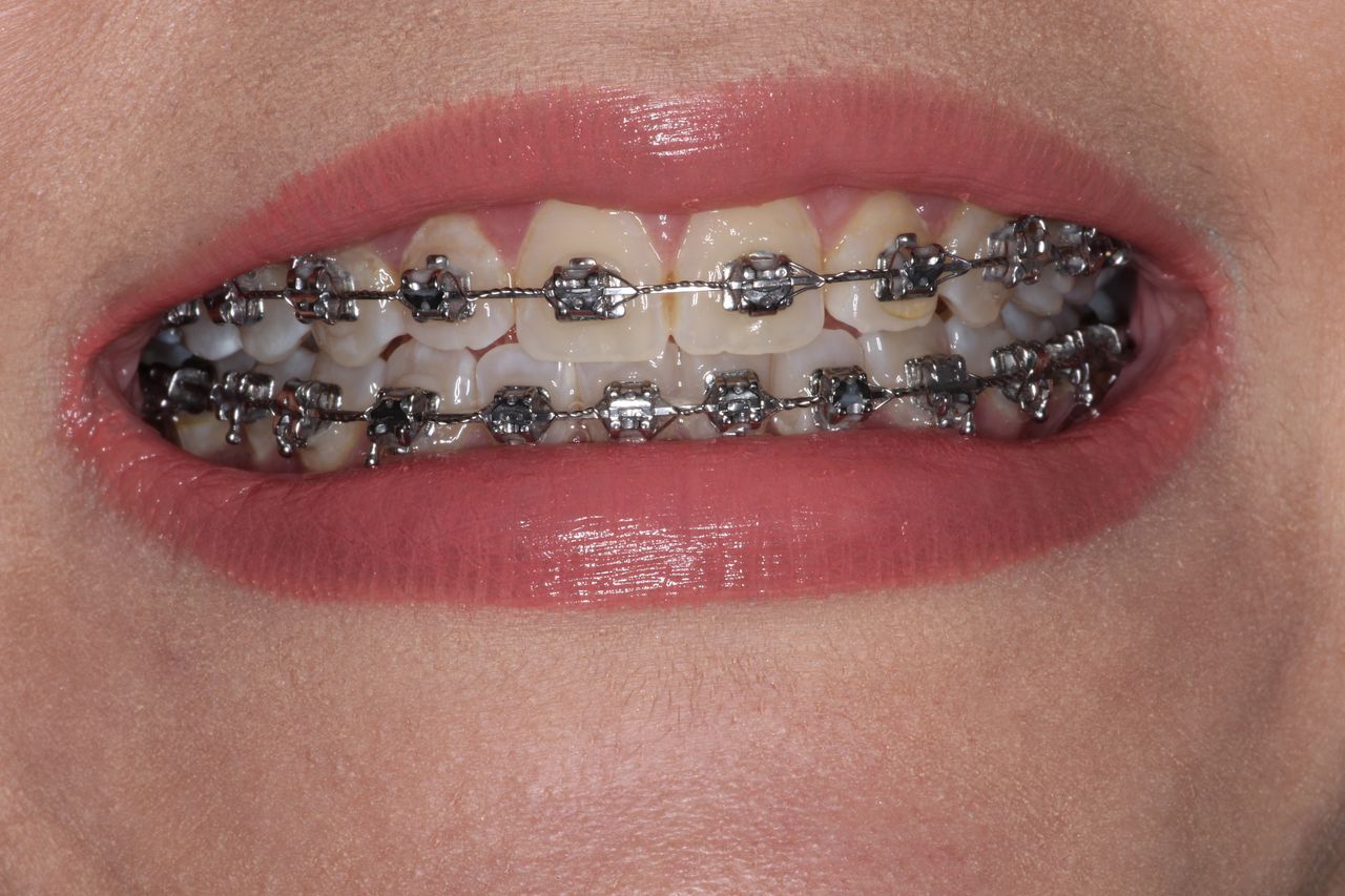 Sergio Torres Rivera-10