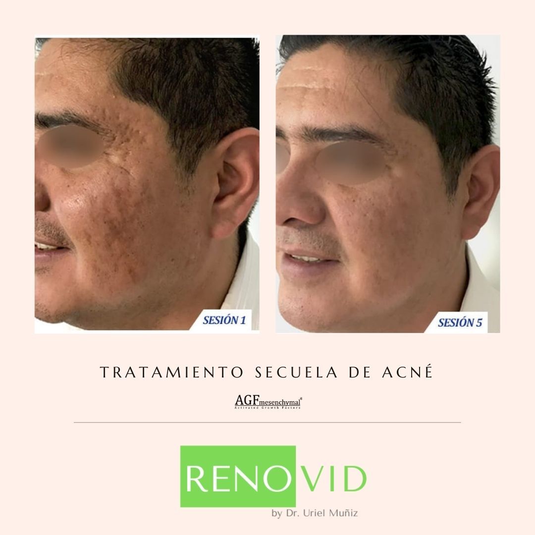 Teófilo Uriel Muñiz Chávez-54