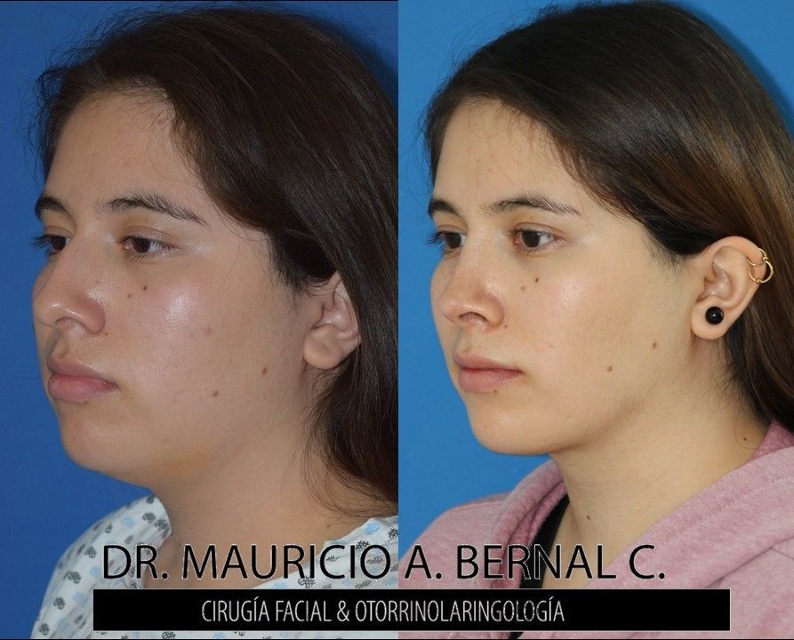 Mauricio Alejandro Bernal Carreon-31