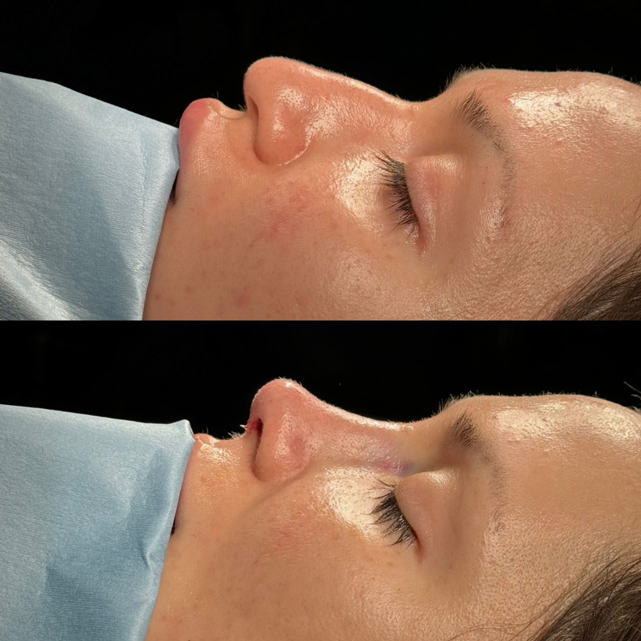 Angel Castro Urquizo-87