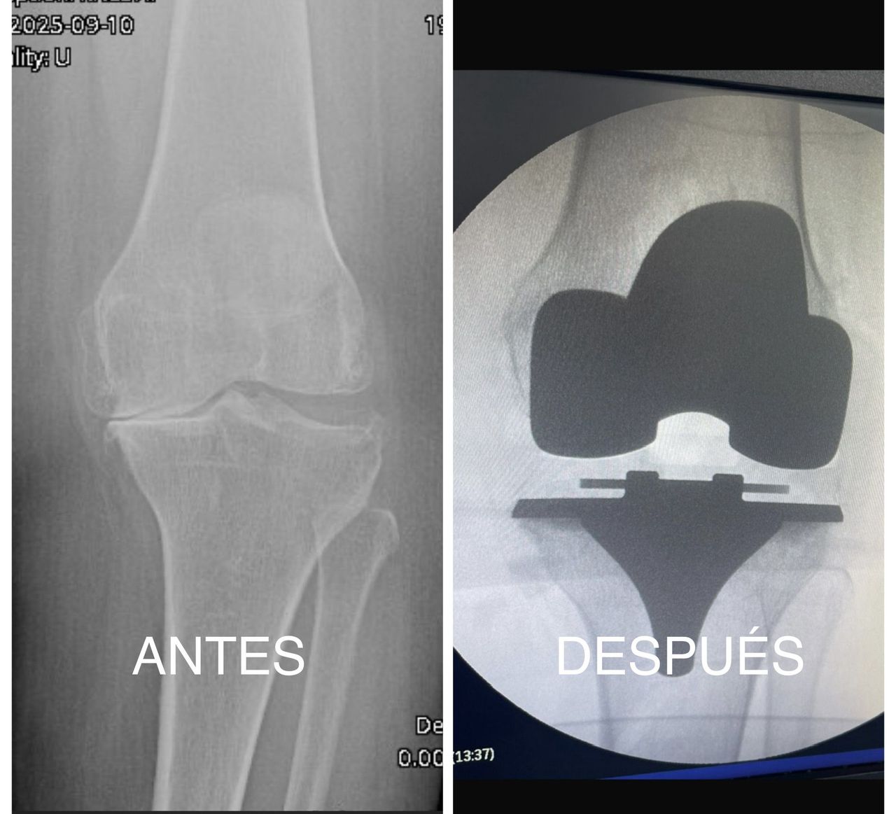 Luis Miguel Pacheco-5