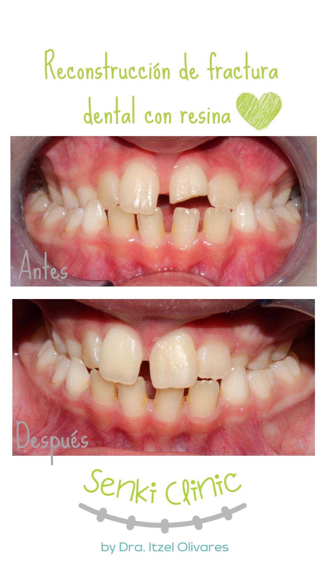 Itzel Olivares Lara-17