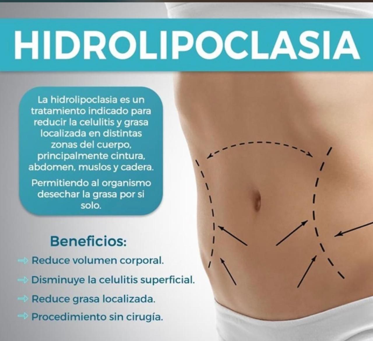 Raquel Román Yáñez-18