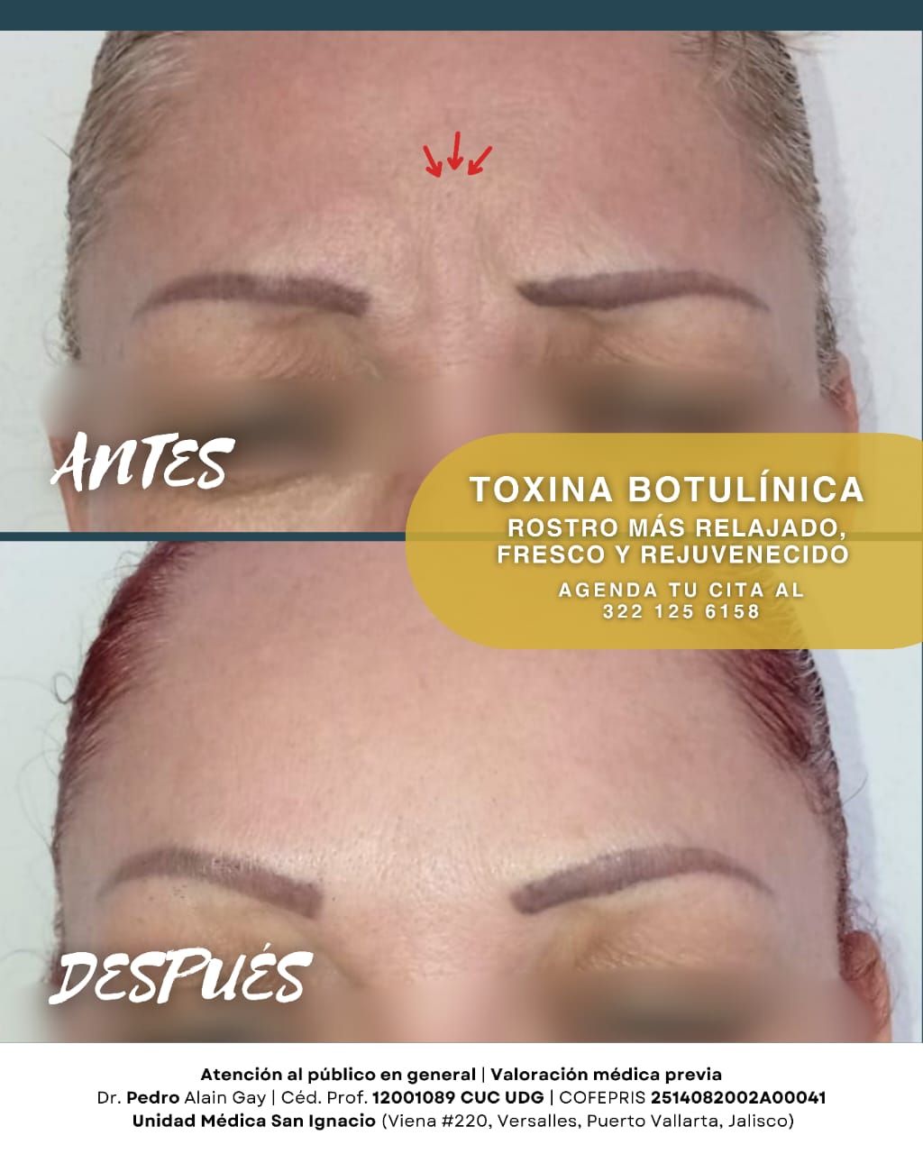 Pedro Alain  Gay Hernández -6