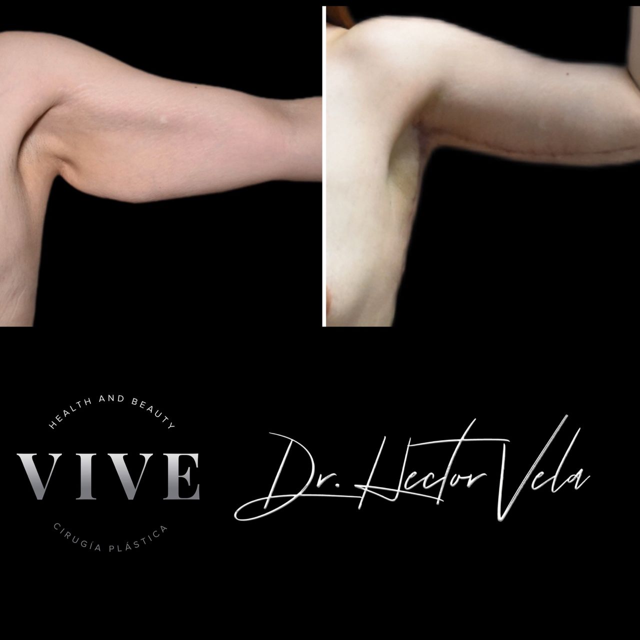 Héctor Eduardo Vela Cardona-247