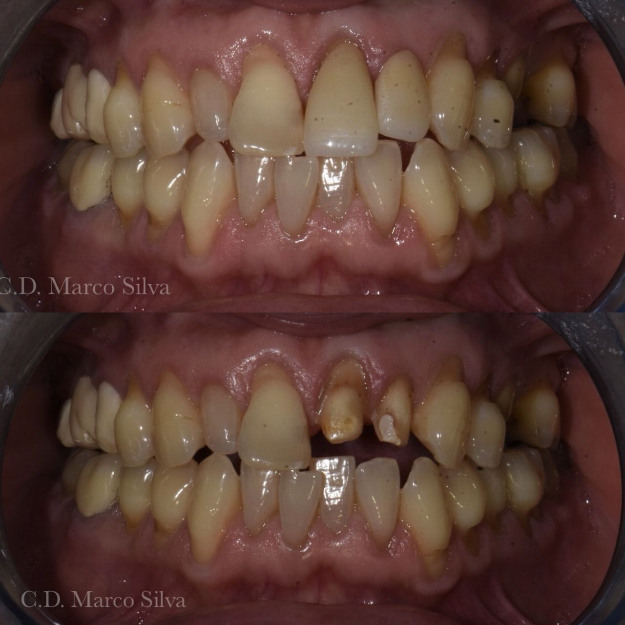 Marco Antonio Silva-19